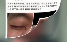 眼科专家谈郭艾伦:结膜受伤经处理大概率恢复得不错 不要太忧心